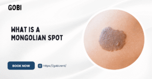 Qu'est-ce qu'une tache mongole ?