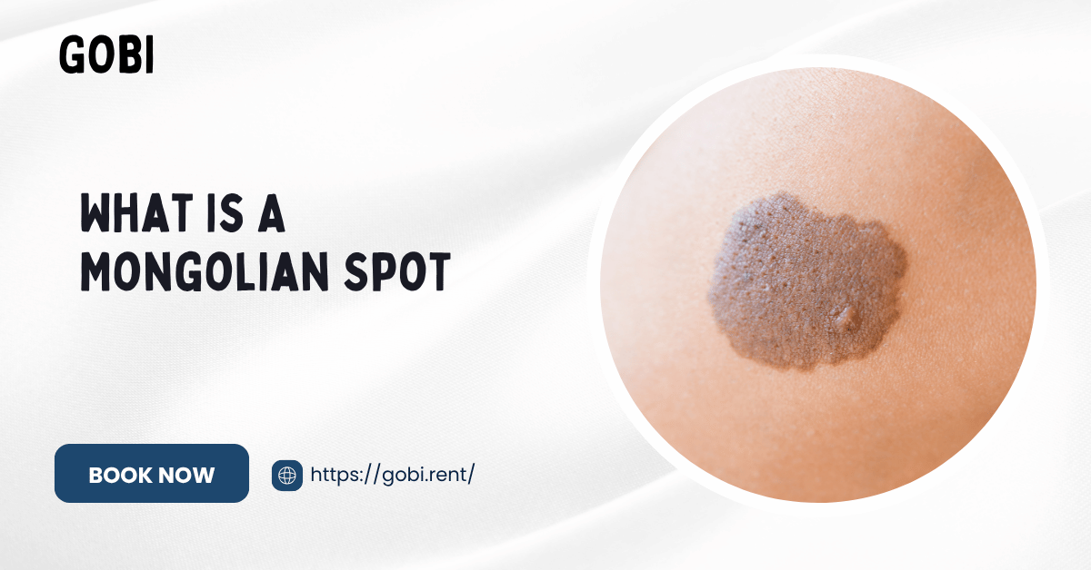 Qu'est-ce qu'une tache mongole ?